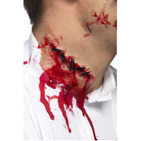 Stitches Scar